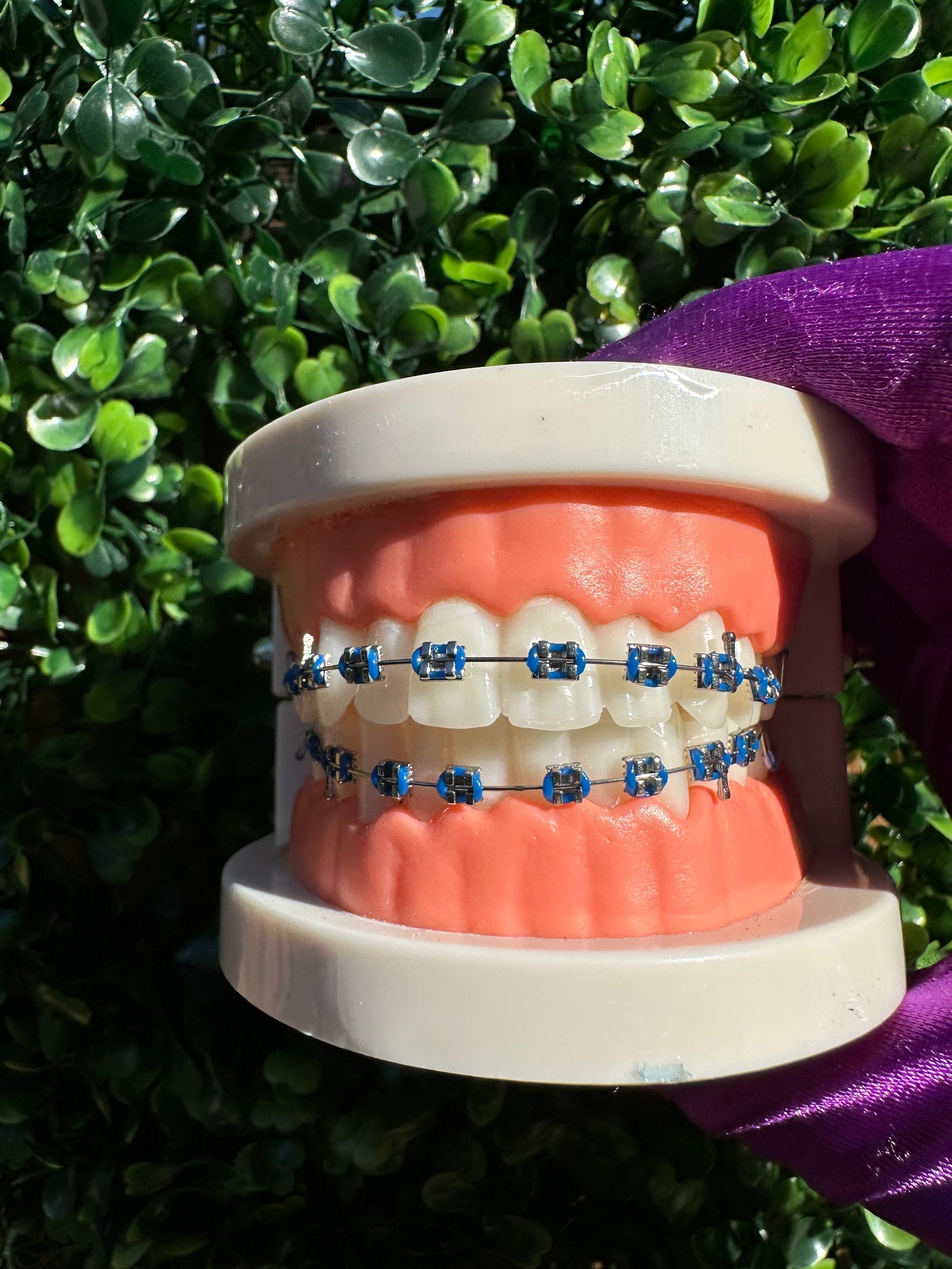 Olinaa® Clip-on Braces VIP