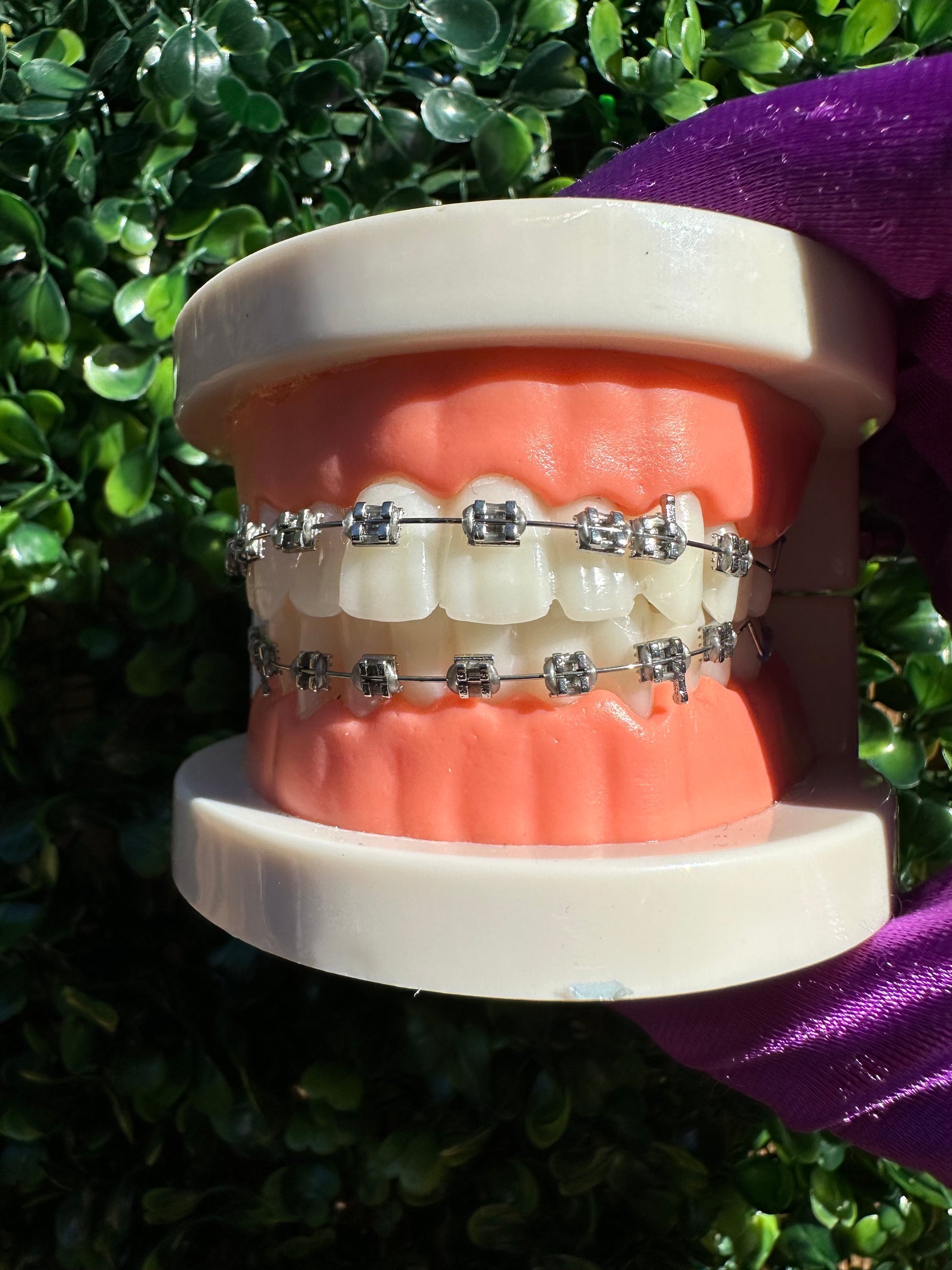 Olinaa® Clip-on Braces VIP