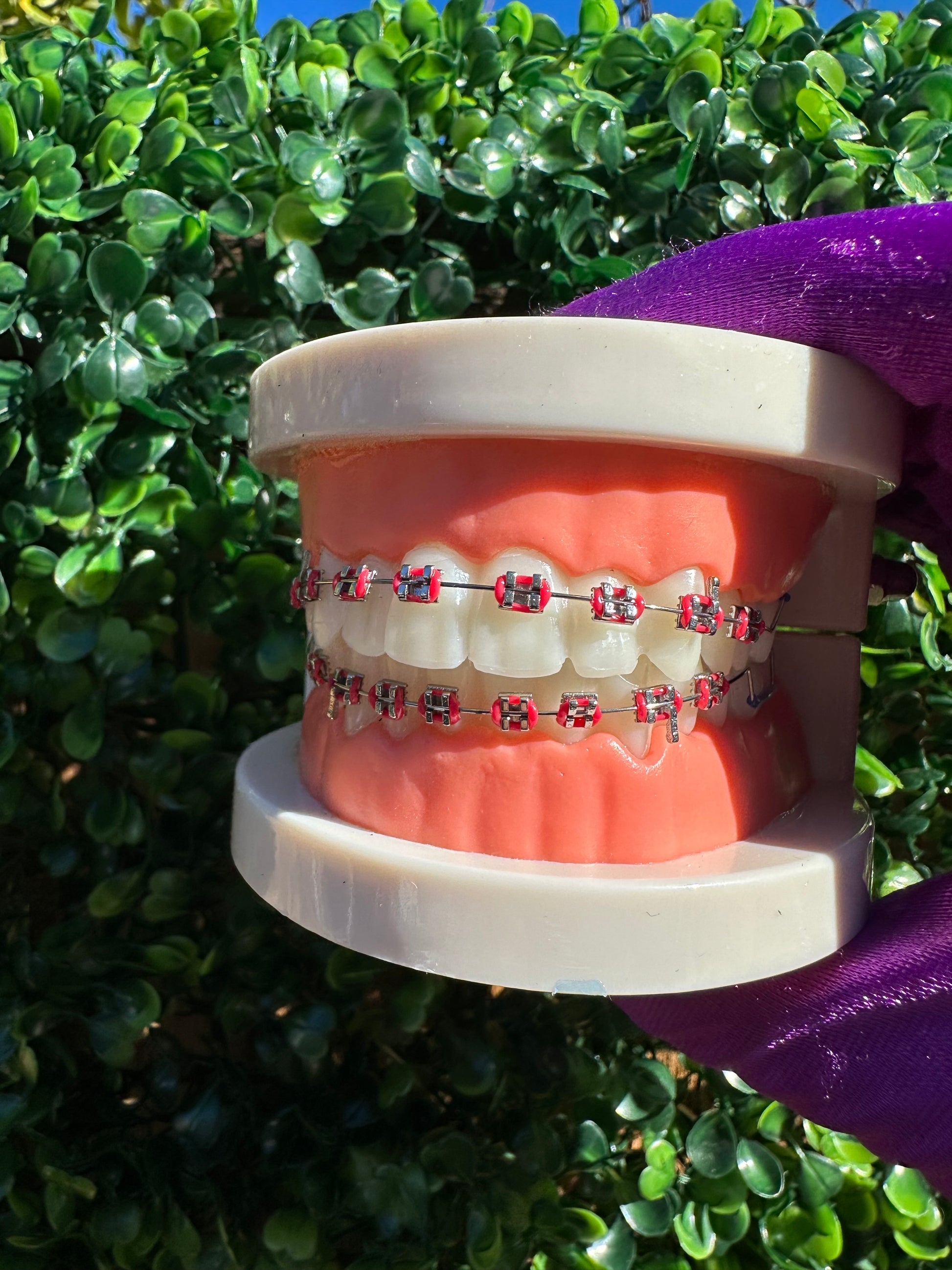 Olinaa® Clip-on Braces VIP