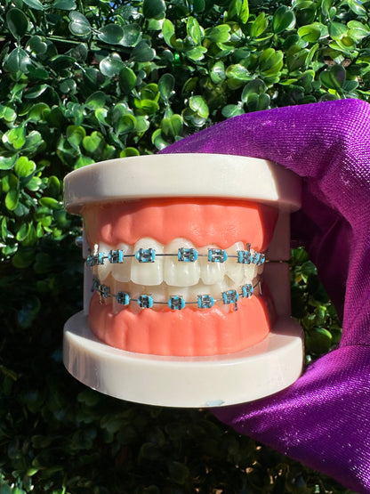 Olinaa® Clip-on Braces VIP
