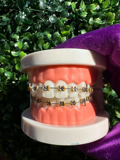 Olinaa® Clip-on Braces VIP