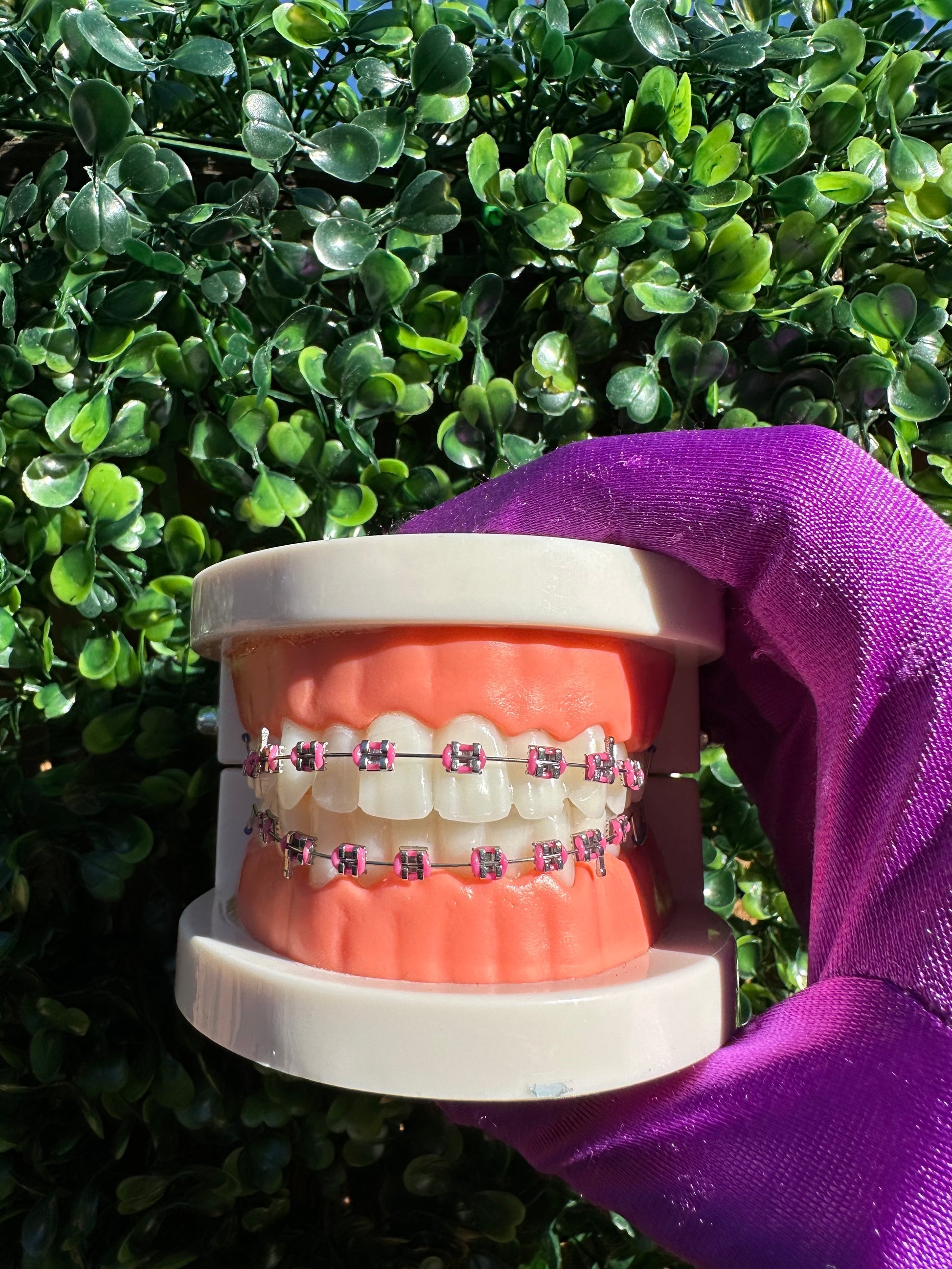 Olinaa® Clip-on Braces VIP