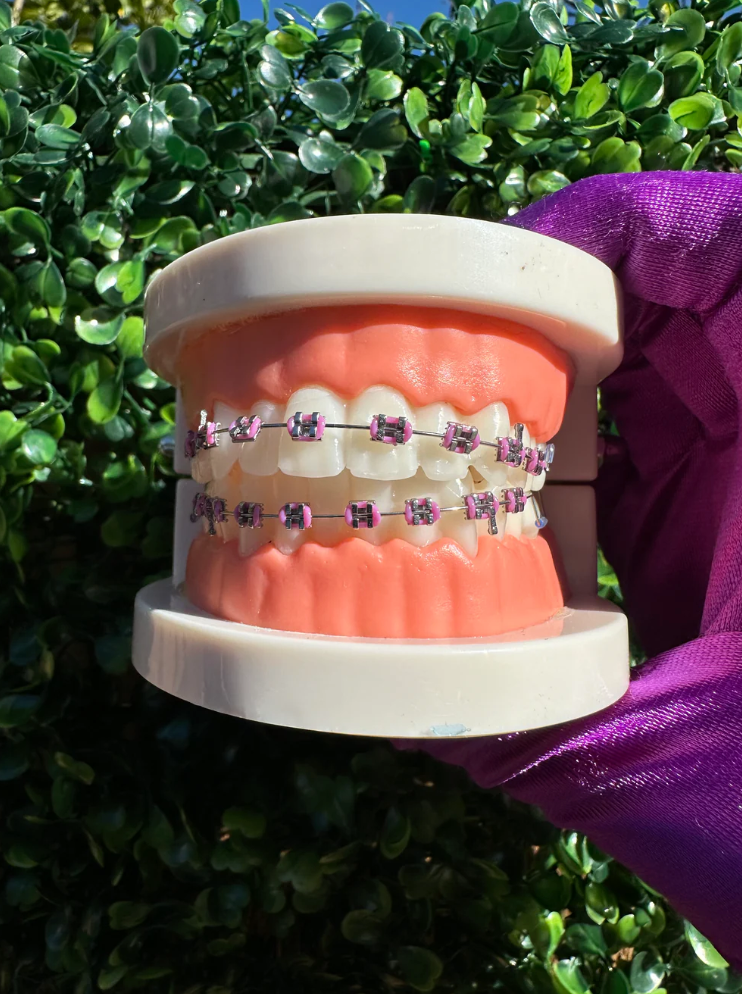Olinaa® Clip-on Braces VIP